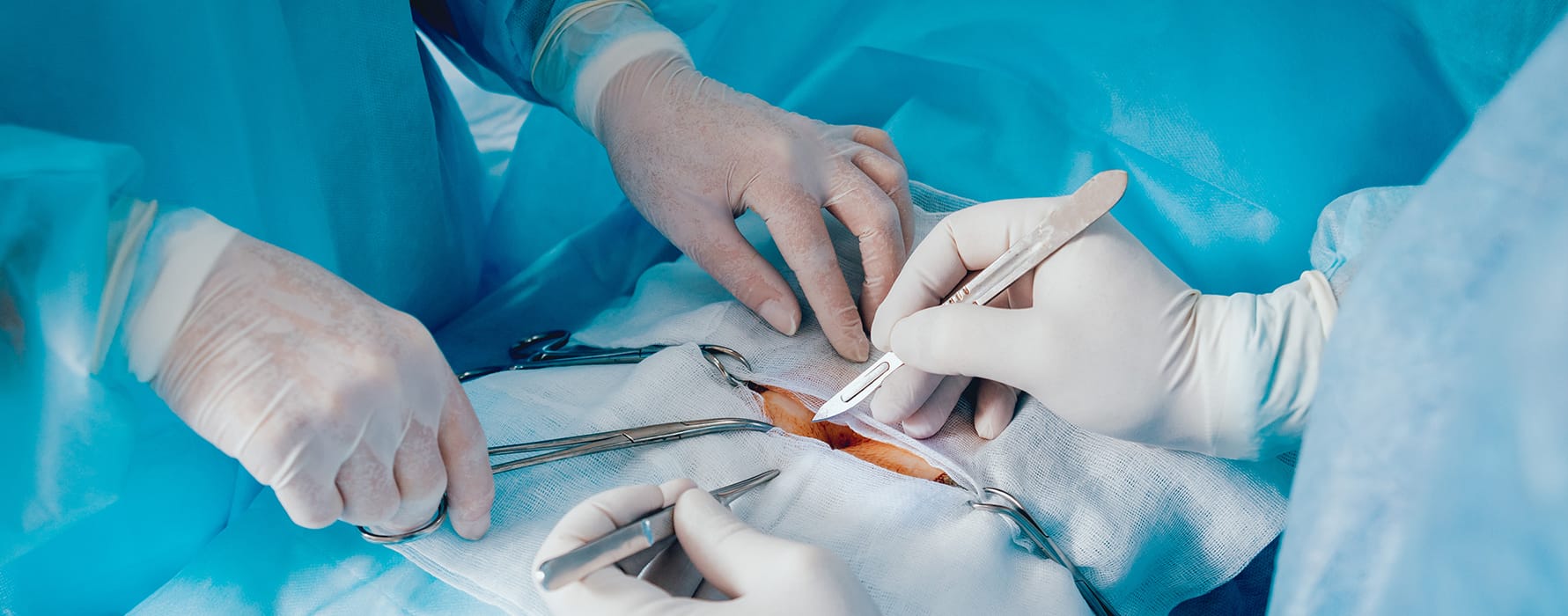 Why Choose Gastric Sleeve Turkey for Safe and Affordable Bariatric Surgery